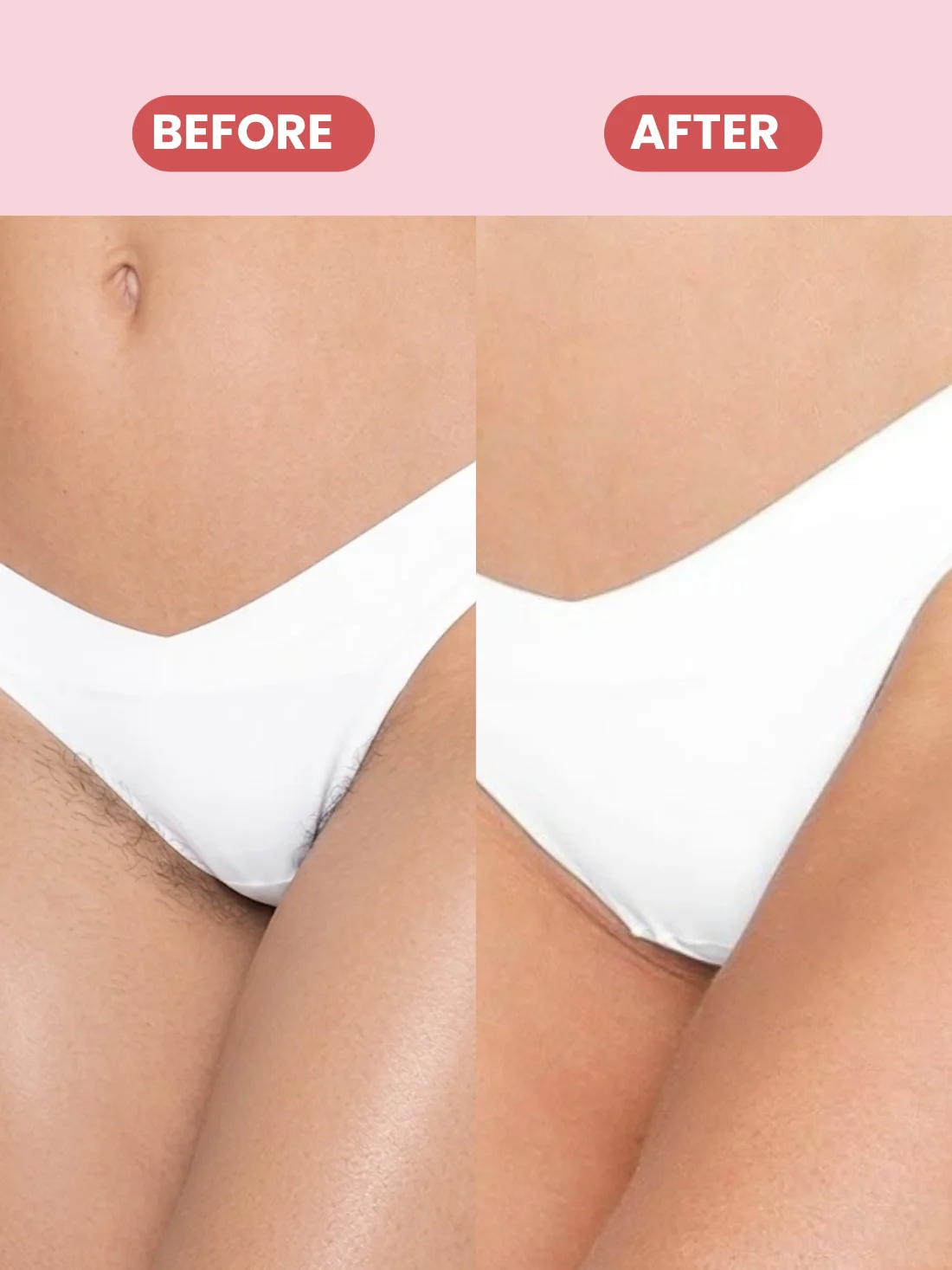 Bikini Hair Removal Spray – 10 Minute Painless Formula - Image 2